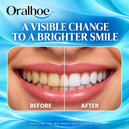 Oralhoe 7.5% Nano-Hydroxyapatite Toothpaste – Fluoride-Free, Enamel Care & Gentle Whitening, Fresh Mint, 4.23 oz-EDC